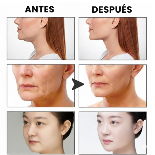 Tiras Derma Lifting Natural Antiedad - Tecnica Coreana